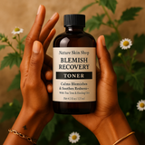 Hand holding a bottle of 'Blemish Recovery Toner' with a natural background