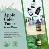 Apple Cider Vinegar + Rose Water Toner - Prevent Breakouts and Minimize Blemishes with Soothing Lavender Oil - Nature Skin Shop